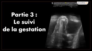 9.7K views · 67 reactions | Quelles sont les étapes cruciales de la gestation ? Si vous avez manqué les épisodes précédents, retrouvez celui sur la fertilité ici : https://cutt.ly/qt071Nw et celui sur l’insémination ici : https://cutt.ly/1t073YA | Grand Prix | Facebook