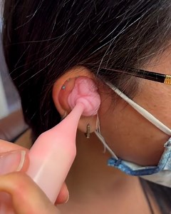 4M views · 6.1K reactions | Why is it so much fun to look inside peoples’ ears? Follow Dr. Ear Wax (https://www.tiktok.com/@dr_ear_wax?is_copy_url=1&is_from_webapp=v1) for more! | BuzzFeed Video | Facebook