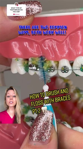 How to Properly Brush and Floss with Braces