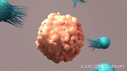 A powerful sight: Watch as T-cells, the white blood cells of our immune system, attack and destroy a cancer cell. This animation illustrates the intricate process of the T-cells releasing cytotoxic proteins to attack the cancerous cell. The immune system is truly a wonder of nature, and these T-cells play a critical role in protecting us from disease. Credit: Design Cells / Science Photo Library https://sciencephoto.com/media/1183266 #cancer #immunology #Tcells #cellularbiology #animation #medic