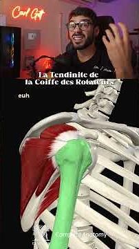 La tendinite de la coiffe des rotateurs