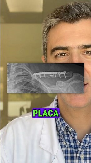 What is surgery for a CLAVICLE FRACTURE?