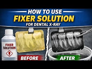 How to Use Fixer Solution for Dental X-Ray Film | Clear X-Ray in Minutes