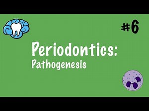Periodontics | Pathogenesis | INBDE, ADAT