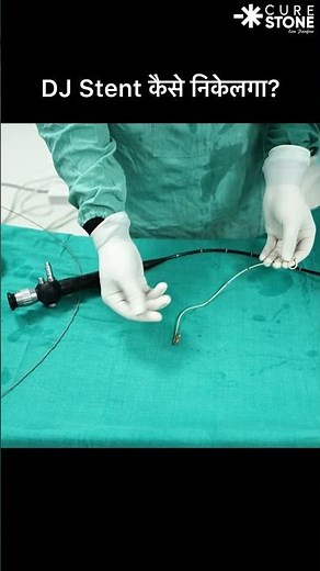 Does DJ Stent Removal Actually Hurt? The Painless Truth Revealed! 🤯 | Dr. Deepanshu Gupta