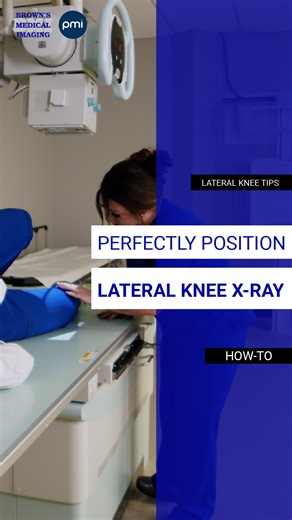 𝗧𝗵𝗲 𝗹𝗮𝘁𝗲𝗿𝗮𝗹 𝗸𝗻𝗲𝗲 𝗽𝗿𝗼𝗷𝗲𝗰𝘁𝗶𝗼𝗻 𝗶𝘀 𝗼𝗻𝗲 𝗼𝗳 𝘁𝗵𝗲 𝗺𝗼𝘀𝘁 𝗿𝗲𝗽𝗲𝗮𝘁𝗲𝗱 𝗶𝗺𝗮𝗴𝗲𝘀—𝗵𝗲𝗿𝗲’𝘀 𝗵𝗼𝘄 𝘁𝗼 𝗴𝗲𝘁 𝗶𝘁 𝗿𝗶𝗴𝗵𝘁 𝘁𝗵𝗲 𝗳𝗶𝗿𝘀𝘁 𝘁𝗶𝗺𝗲.​ ​​ ​✅ Patient Positioning: Roll the patient onto their affected side and flex the knee 20–30 degrees.​ ​✅ Tube Angle: Use a 5–7 degree cephalic angle to ensure true superimposition of the condyles.​ ​​ ​💡 This angle accounts for the medial condyle extending slightly more distally than the lateral, ensuring 