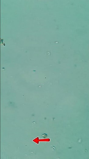 Two different types of protozoa movement #microcosmos