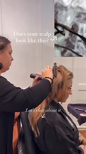 11K views · 31 reactions | Did you know that a healthy scalp is...