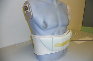 Mobilysis - dialysis made portable - Stefan Silberfeld