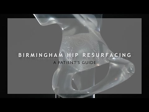 Birmingham Hip Resurfacing (BHR) | Symptoms & Diagnosis | Hip Surgery | Hip Arthritis