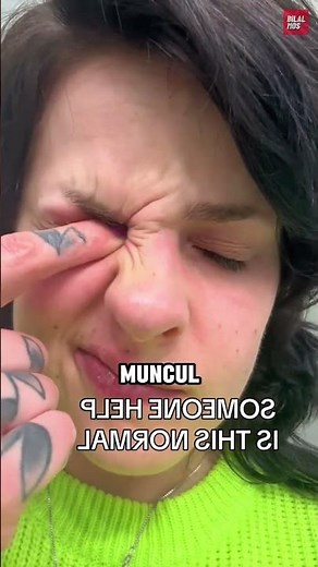 Kenapa Mata Bisa Mengeluarkan Suara?