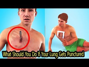 What Should You Do If Your Lung Gets Punctured