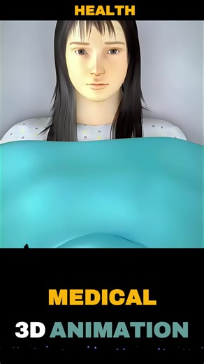 How a Female Foley Catheter Is Gently Inserted to Drain the Bladder! #foleycatheter #FemaleHealth #urinarycatheter #urinarybag l #medicalanimation