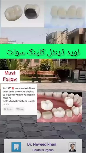 Understanding Tooth Crowns: Purpose and Procedure