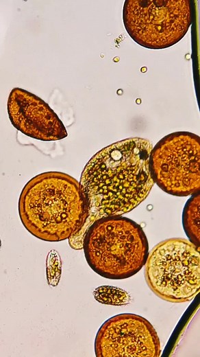 Identify the organisms. #medicalstudent #Microscopy #microbiologylab #parasitology #stoolexamintion