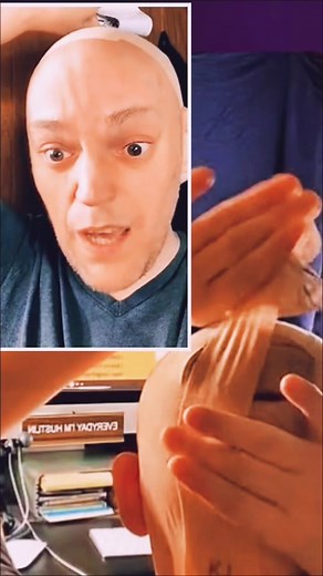 How to Properly Apply a Bandage on Your Head