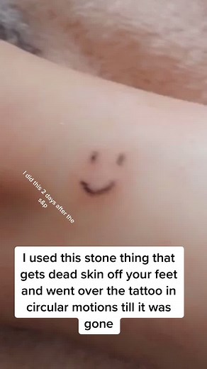 How to get rid of a stick and poke #howtogetridofstickandpokes #stickandpokes #tattoo #HELP #smiley #TechTokTips #AirpodsJUMP #LiveForTheChallenge