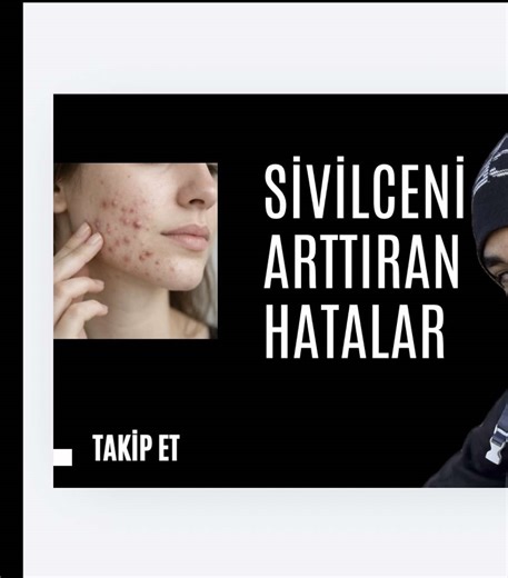 Sivilceyi Çıkaran Hatalar ve Çözümleri