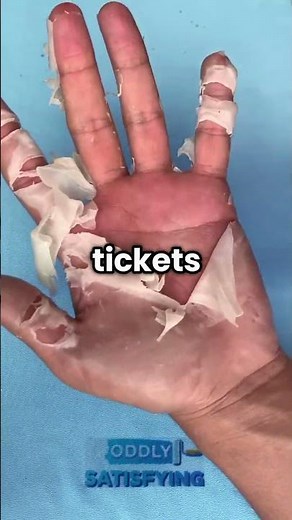 What Did He Pull Out..🤔