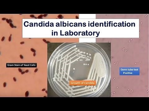 Candida growth on SDA, Gram stain and Germ tube test Positive
