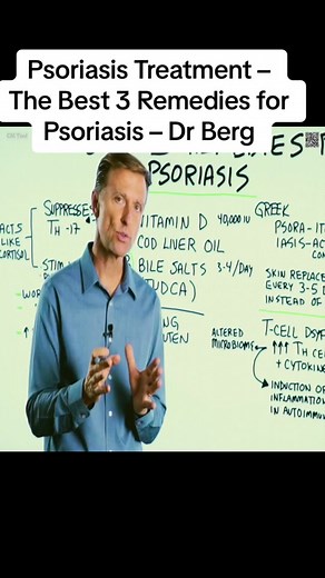 Psoriasis Treatment – The Best 3 Remedies for Psoriasis – Dr Berg #drama #drawing #doctor #health #dreric #dreric #drericberg #drericbergdc