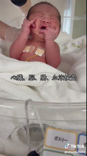 生まれたばかりの赤ちゃんの健康問題について