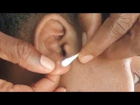 Face nitpicking, mild bubblegum chewing, whispers for your mind relaxing #asmr #asmrsounds