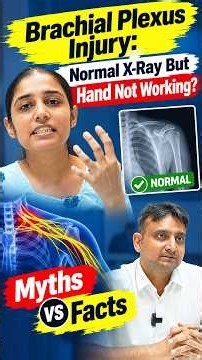 Brachial Plexus Injury: Normal X-Ray But Hand Not Working? | Myths vs Facts