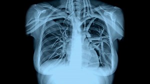 6.4K views · 18 reactions | What do you notice? | Respiratory Therapy Zone | Facebook