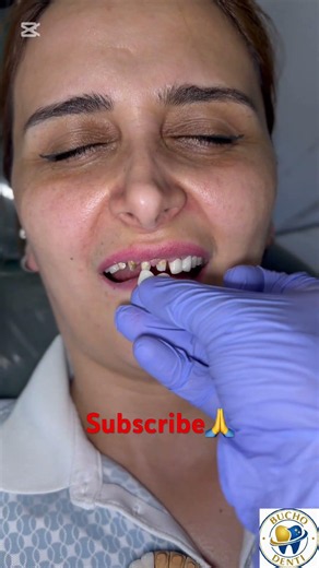 We are a global dental designer in Georgia,free online consultation WhatsApp+995597010317