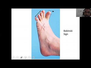 #Babinski Sign #Normal and Abnormal Plantar reflex#NeuroPhysiology #CNS #PhysiologyLecturesForMBBS