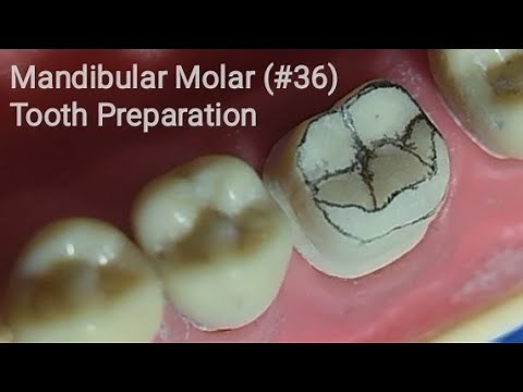 Dr VK's Dental Skool | MANDIBULAR FIRST MOLAR PREPARATION |ALL CERAMIC | METAL CERAMIC (PFM) CROWN