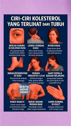 ⚠️ 9 Tanda Kolesterol Tinggi yang Sering Diabaikan! Cek Sebelum Terlambat!