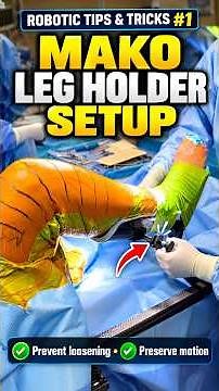 Mako Robotic Tips & Tricks #1: How to Set Up the Total Knee Leg Holder Correctly