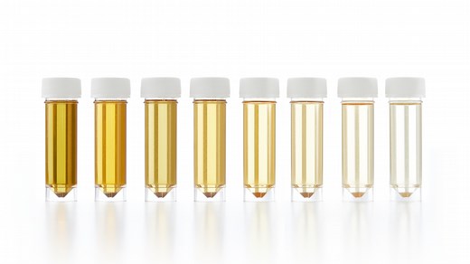 What colour should urine be?