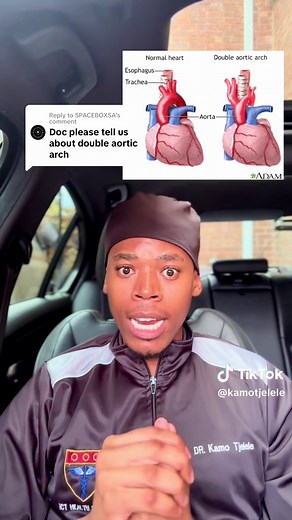 Understanding Double Aortic Arch: A Guide to CHD