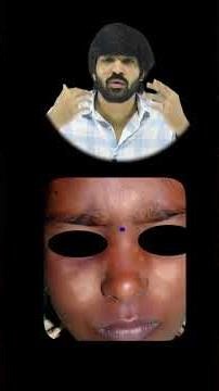White Spot on Face