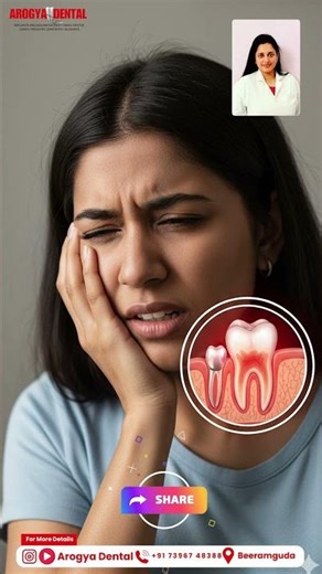 Wisdom Tooth Pain? Safe & Painless Treatment in Beeramguda | Arogya Dental Hospital