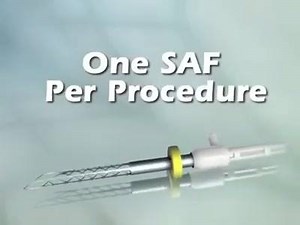 11K views · 273 reactions | This file adapts to root canal shapes... Self Adjusting Files (SAF).... "Any one using it???"  | Mind Dentistry | Facebook