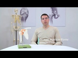Arthrose im Schultergelenk - Gelenkersatz