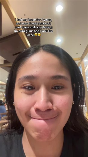 Shaka Sign and Braces: A Journey Through Smiles