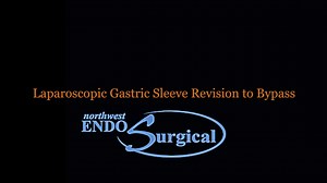 Gastric Sleeve to Bypass Revision