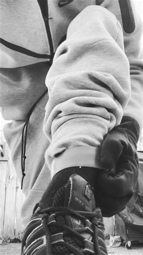 #fyp #otr standard procedure