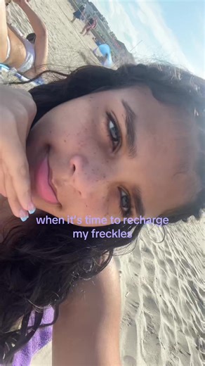 #fyp #foryoupage #relatable #xyzbca #freckles #Summer #hamptonbeach | Freckles
