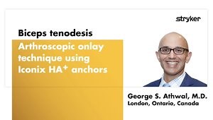 Biceps Tenodesis Arthroscopic Onlay Technique Using All-Suture Anchors
