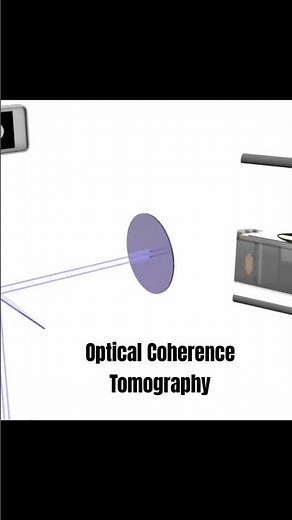 Optical Coherence Tomography