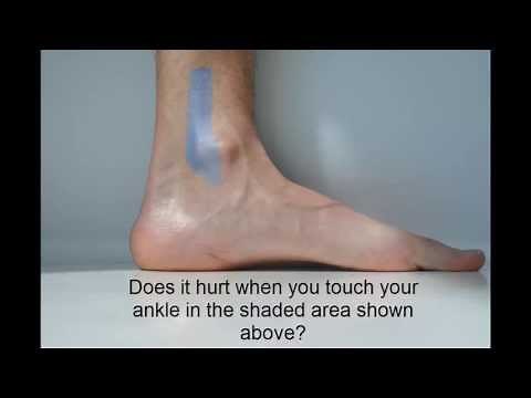 Medial malleolus palpation