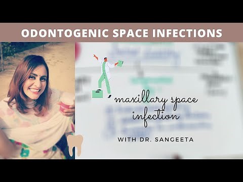 spread of infection in fascial spaces - maxilla