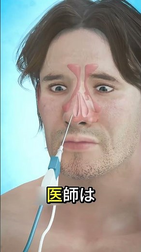 Can you cure a nose with a balloon?