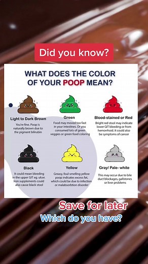Understanding Stool Color: What Different Colors Mean